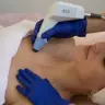 RF-LFTING На апараті-BTL EXILIS ELITE- Декольте.