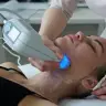 RF-LFTING На апараті-BTL EXILIS ELITE-Друге підборіддя