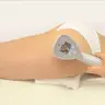 RF-LFTING На апараті-BTL EXILIS ELITE-Стегна та сідниці