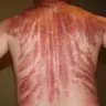 Гуа Ша