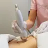 Radiofrequenz-Needling Körper