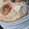 Чистка+Карбоксітерапія