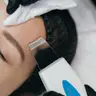 Ультразвукова чистка обличчя