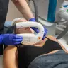 Лазерна косметологія М22 - Видалення Пігментації 20х20 350 грн
