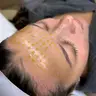 Yellow peel (жовтий пілінг серединний)