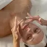 Карбокситерапія «Анти-Акне»