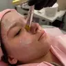 Чистка обличчя