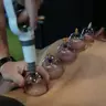 Вакуумно баночний масаж(додаткова послуга до масажу)