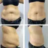 Bodystyling Dipotens (Dilan Polat)