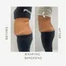 Bodystyling Rasping Dilan Polat (Umfangreduzierung)