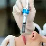 Microneedlling (Lachs-DNA)