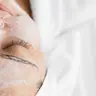 Fotorejoveniment facial amb làser de diòde