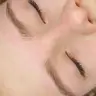 підліткова корекція