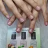 Tratamiento de Recuperación de Uñas