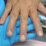 Uñas rellenas