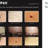 CryoPen: große Alterswarze (seborrhoische Keratose), gewöhnliche Warze