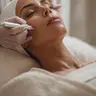 MICRODERMABRASION