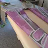 Пресотерапія (схуднення, лімфодренаж)