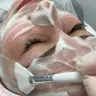 Carboxytherapie