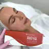Біоревіталізація: Rrs long lasting( гіалуронова кислота+ амінокислоти, точки ліфтингу)