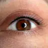 Wimpernkranzverdichtung