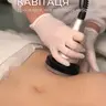 Кавітація ( стегна, спина)