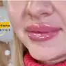 Збільшення губ Aileene (Корея): 1 ml
