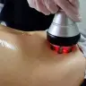RF ліфтинг (стегна задня частина)