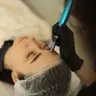 Фракційна мезотерапія (локально)