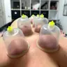 Масаж спини з вакуумними банками