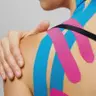 Kineziotaping