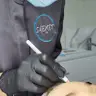Ботулінотерапія