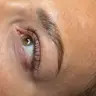 Augenbrauenlifting