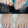 Pedicura estetica