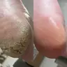 Подологічний педикюр: складний