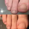 Подологічний педикюр: легкий