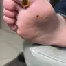 Повторний візит