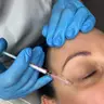 Vitaran Tox eye & face collagen 2 ml