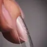 Extension au gel