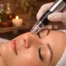 Microneedling amb exosomes ☆