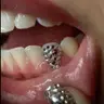 Disco