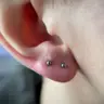 Upper Lobe