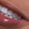 Tooth gem 1 okrągły