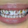 Tooth gems kompozycja L