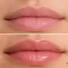 Meso Lips