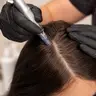 Microneedling für Haarwachstum