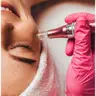 Microneedling