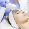 Tratamento Acne IPL