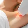 Depilação Laser Axilas