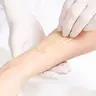 Braços